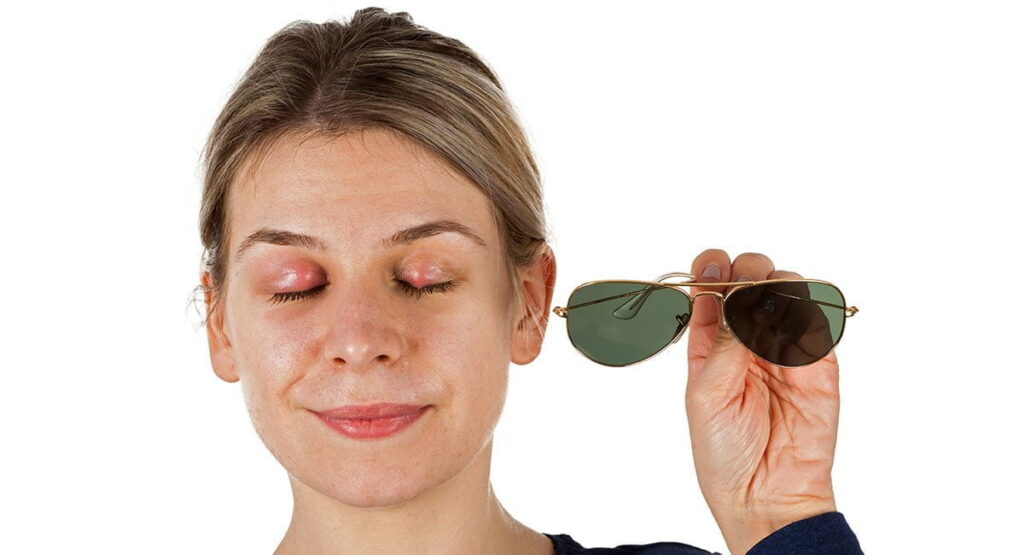 Blefarita, ce trebuie să știți despre inflamația pleoapelor